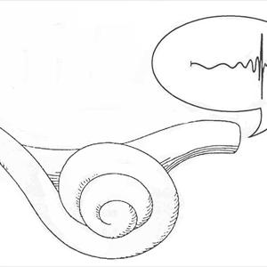 Tinnitus Tratamiento - Study Of The Neuromonics Tinnitus Treatment