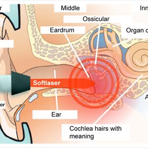 Tinnitus Dx 