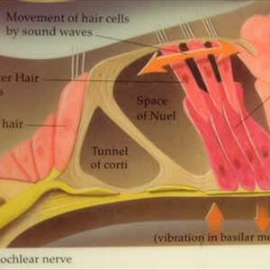 Tinnitus Advice And Help - How I Ended My Search For Real Tinnitus Relief.