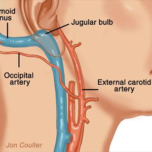 Tinnitus Hypnose - Tinnitus Solution - The Right Choice Of Treatment For Your Disease